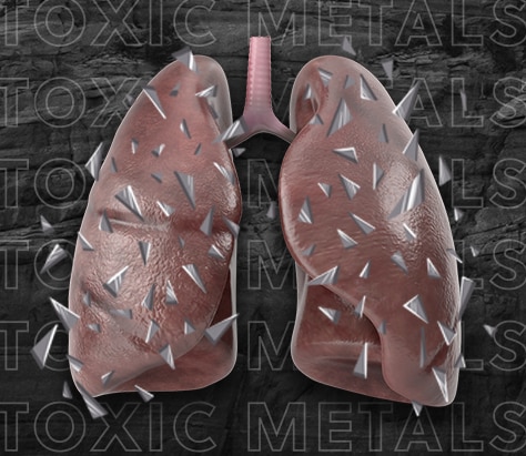 Lungs with sharp metal particles inside.